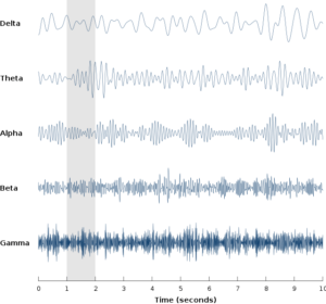 A picture of an EEG scan showing five variably wavy lines for post on nature's effects on the brain
