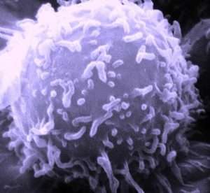 Image of a human lymphocyte, looking like a round ball with little hairs on the outside, taken with an electron microscope, for article on umwelt